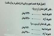 نرخ گرافی تک دندان و OPG بر اساس تعرفه سال 1402 در مرکز دولتی دندانپزشکی سلامت 
